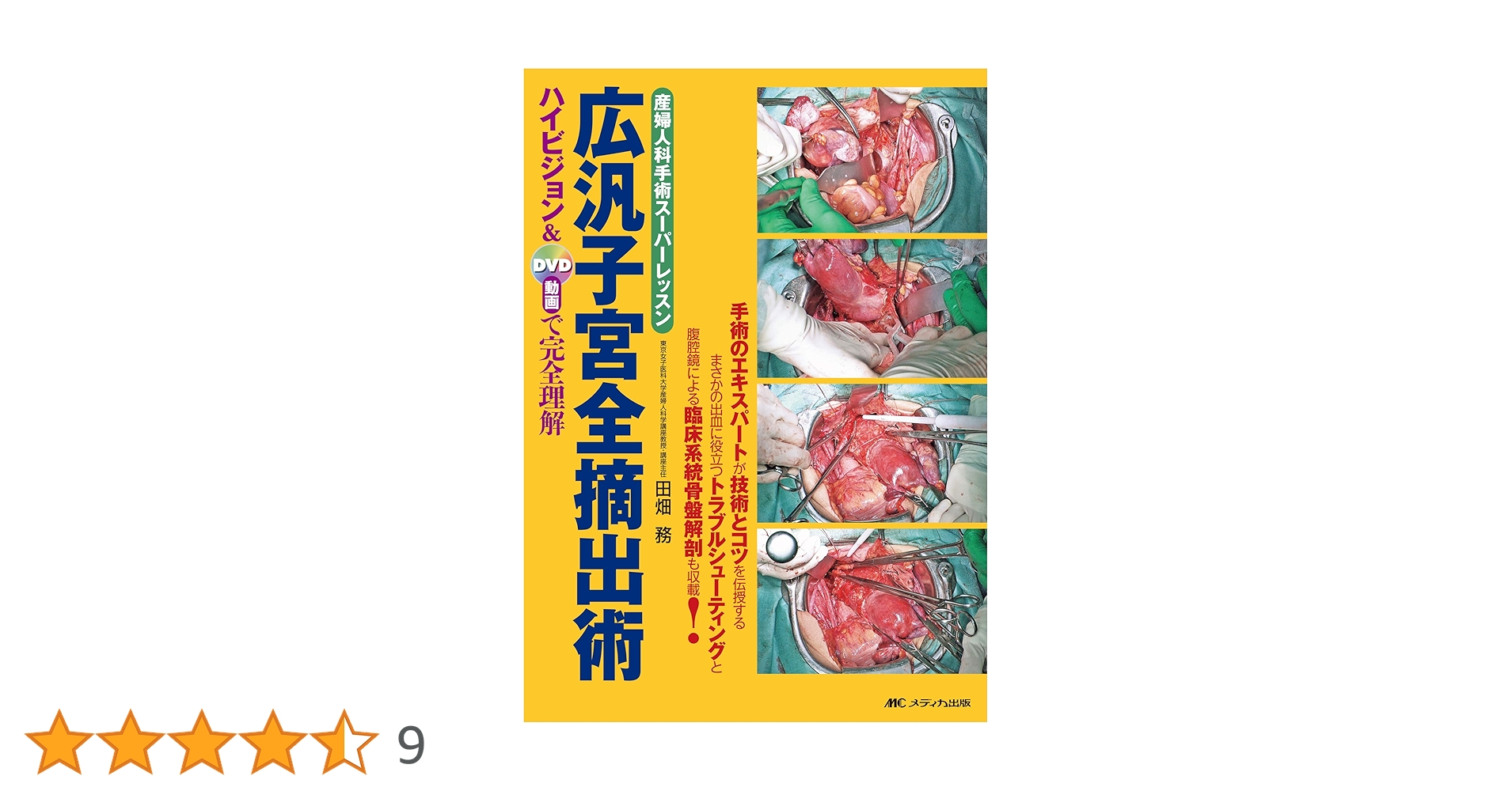 広汎子宮全摘出術 DVD付き 広汎子宮全摘出術: 産婦人科手術スーパーレッスン/ハイビジョン